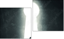 Diptych